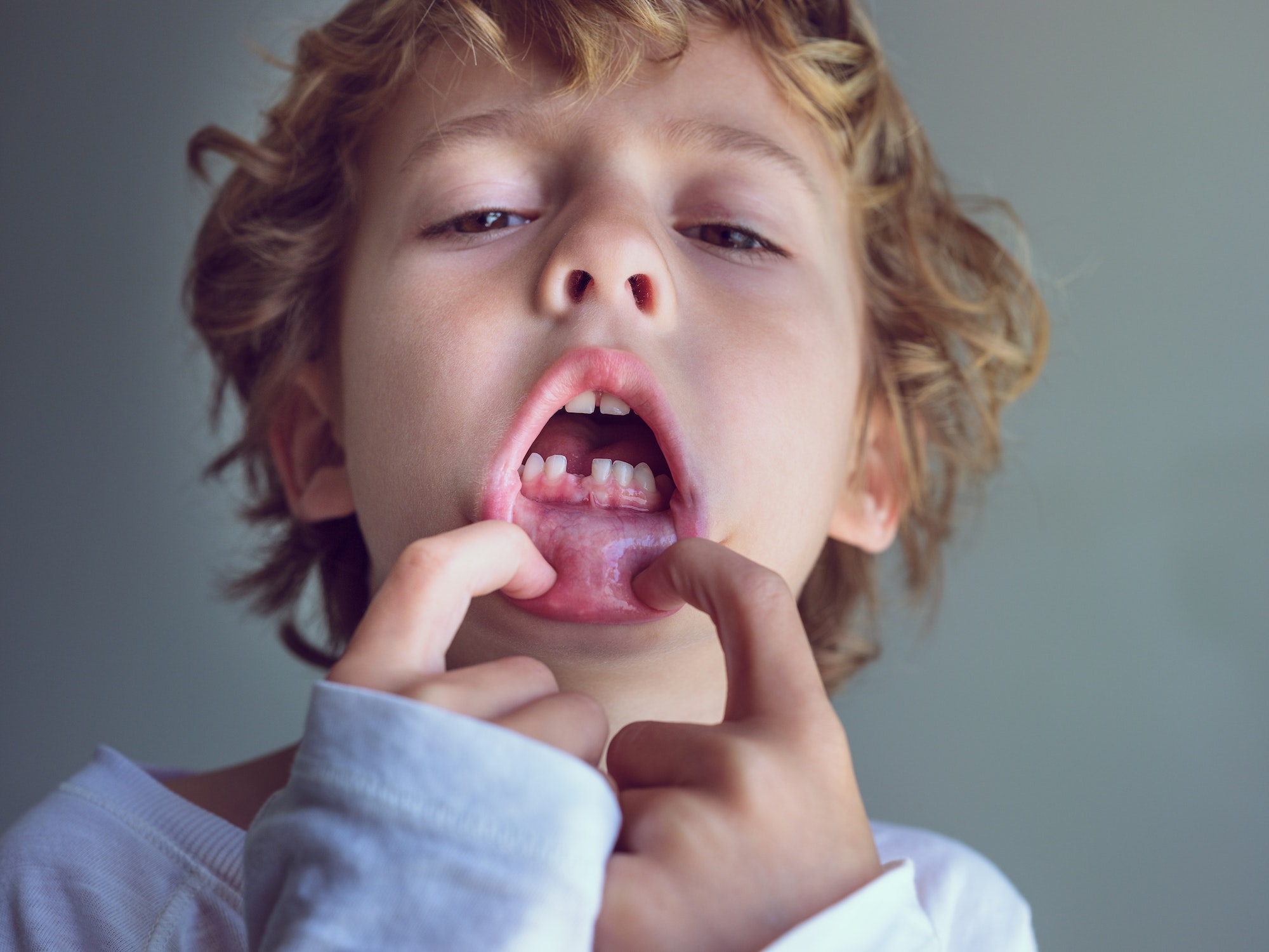 Cute boy demonstrating missing tooth