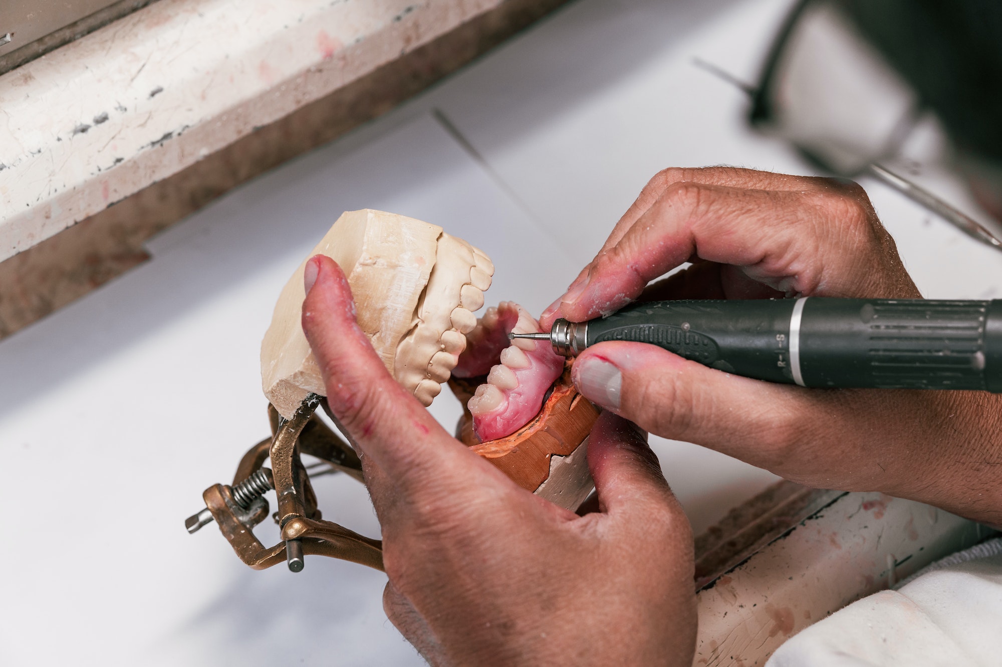 Hands of a dental technician filing a dental implant